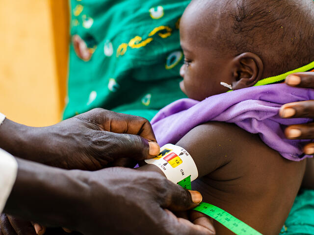 A baby gets his arm circumference measured. 